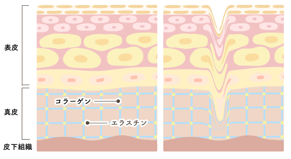 皮膚の構造を理解しよう