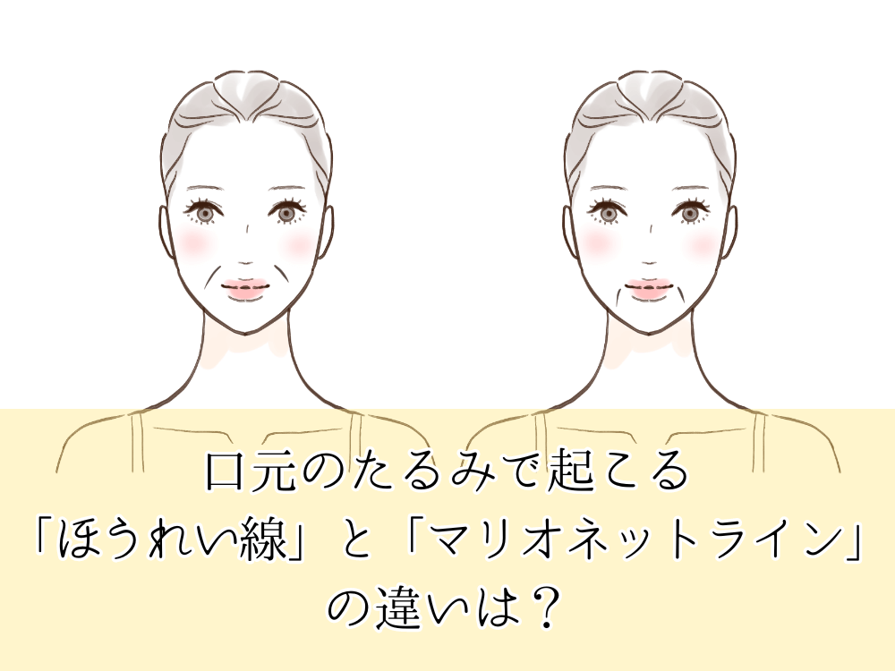 口元のたるみで起こる「ほうれい線」と「マリオネットライン」の違いは？