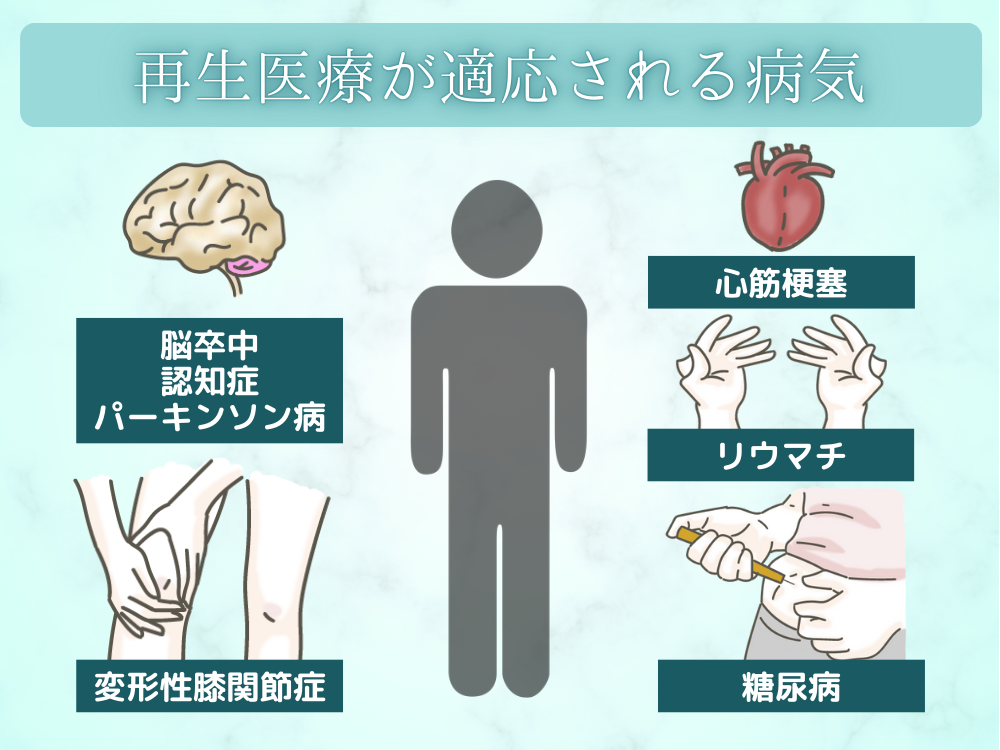 再生医療が適応される病気