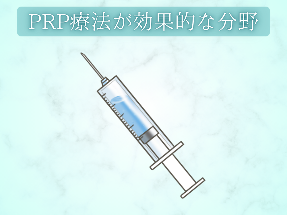 PRP療法が効果的な分野