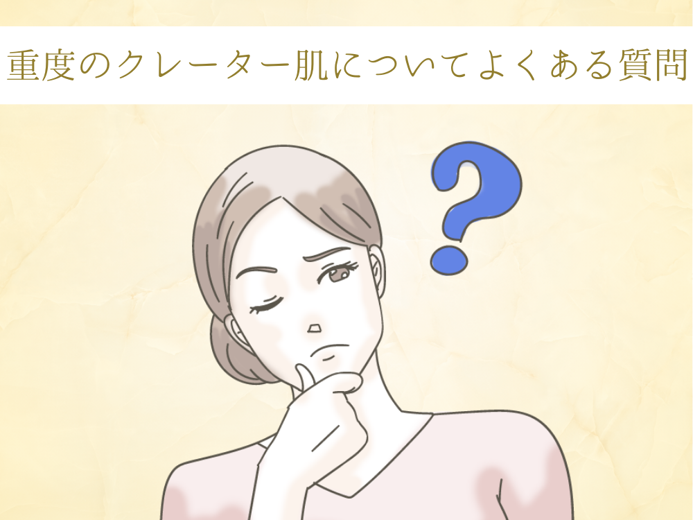 重度の「クレーター肌」についてよくある質問