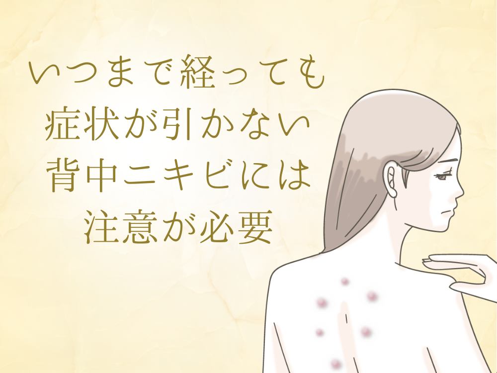 いつまで経っても症状が引かない背中のニキビには注意が必要