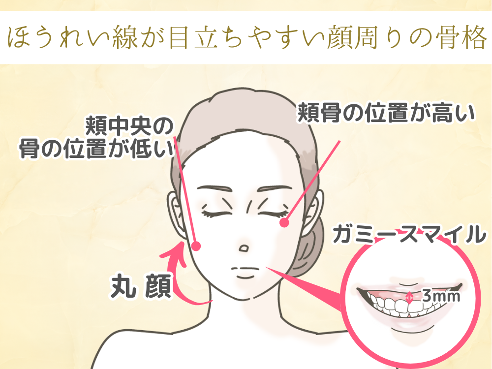 ほうれい線が目立ちやすい顔周りの骨格