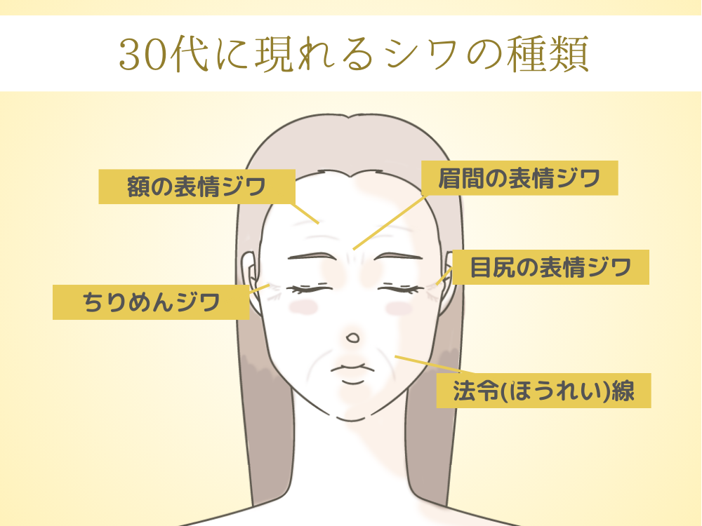 30代に現れるシワの種類