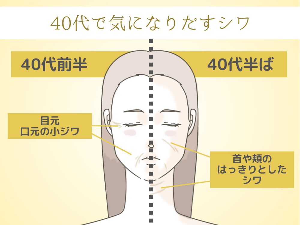 40代で気になりだすシワ