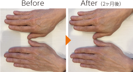手元の肌再生イメージ