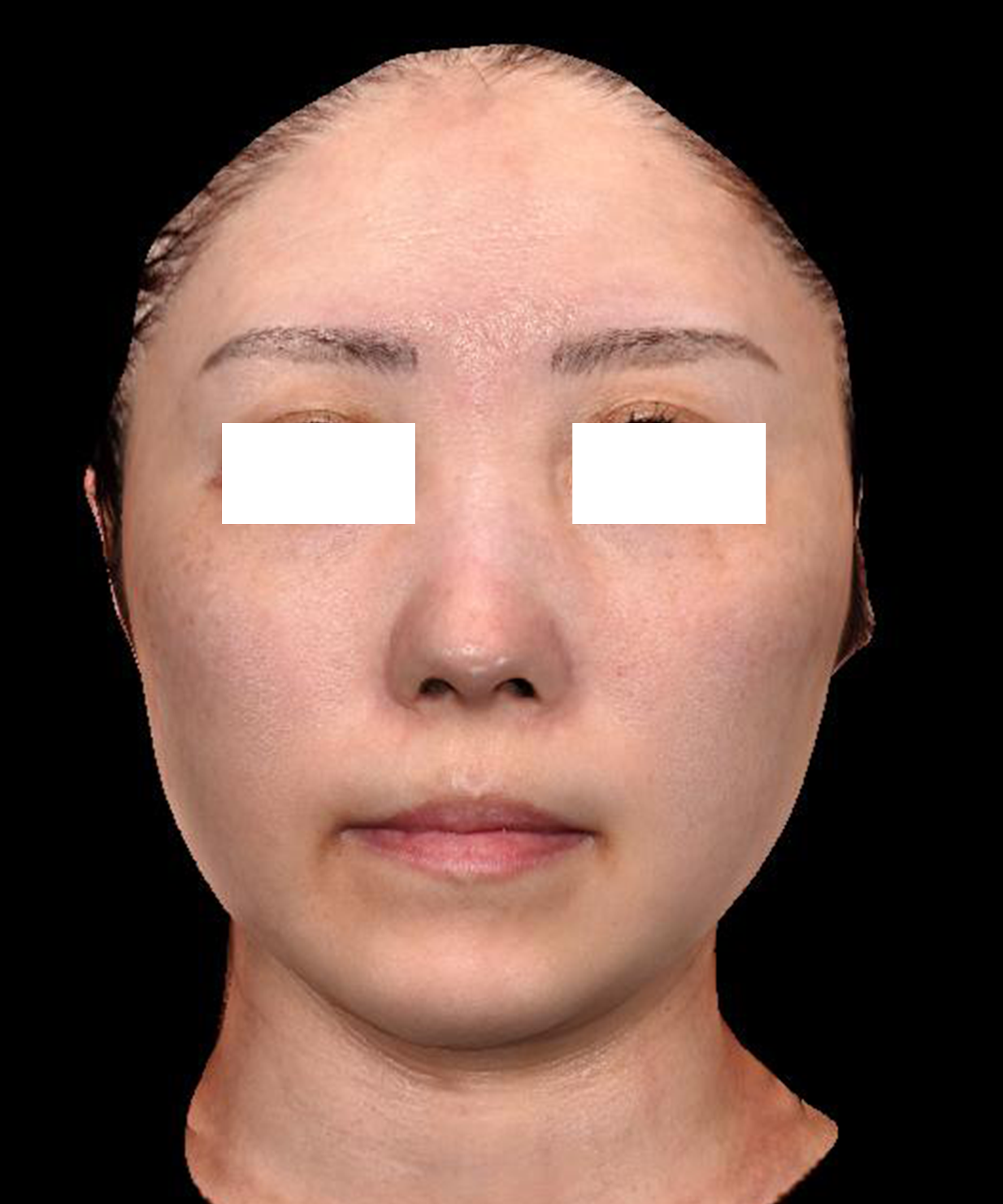 No.81の症例画像