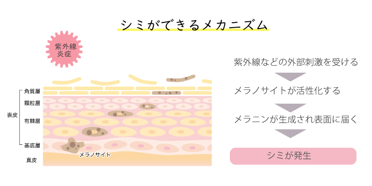 しみの原因