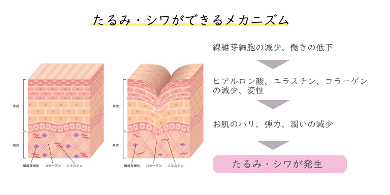 しわ・たるみの原因