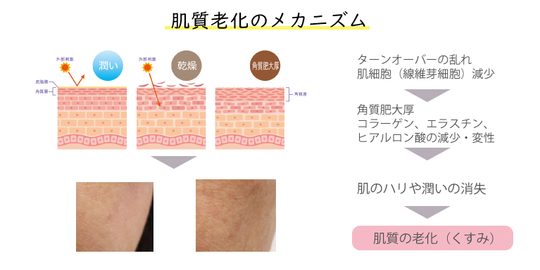 肌質の変化