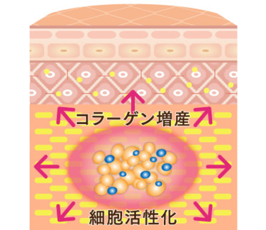 PRP皮膚再生療法