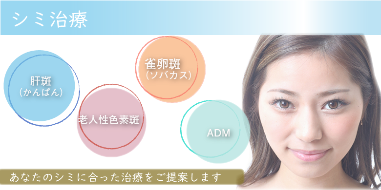 シミ治療 肝斑・老人性色素班・雀卵斑(ソバカス)・ADMなどあなたのシミに合った治療をご提案します