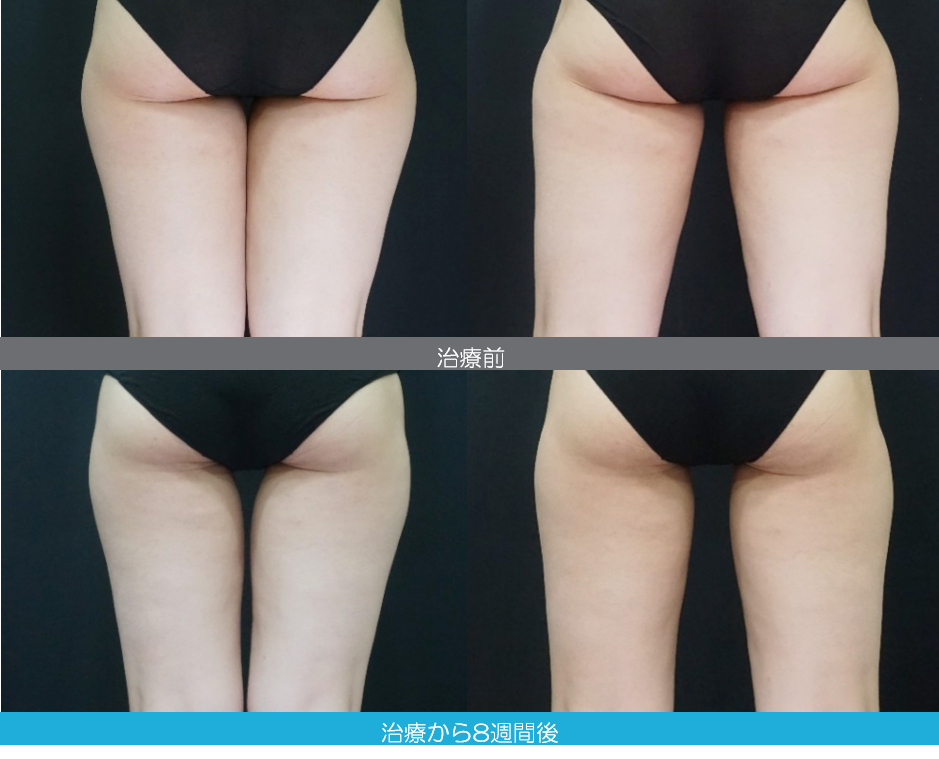 症例写真4