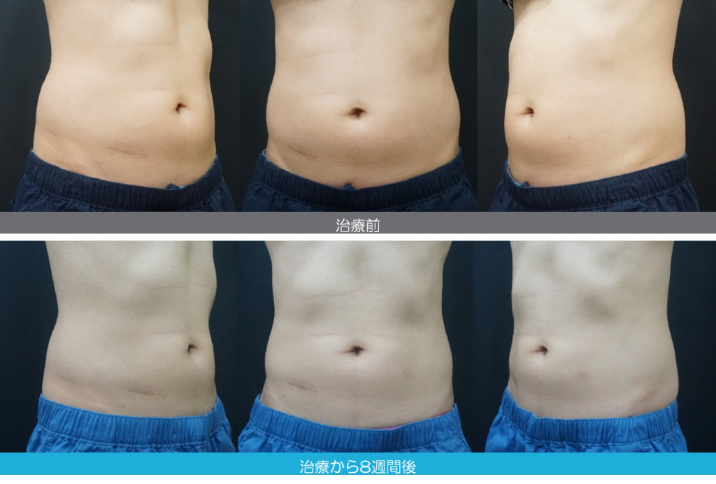 症例写真2