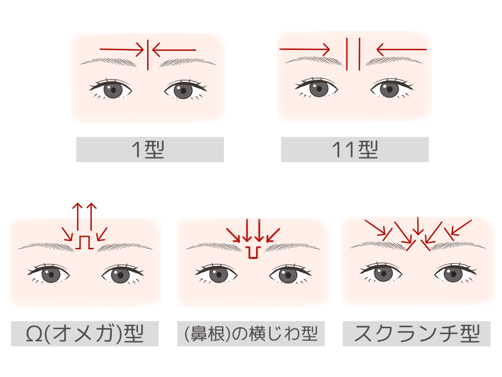 眉間のシワの原因や改善策は?深い眉間のシワを消す治療方法を解説 | フォーシーズンズ美容皮膚科クリニック美容コラム