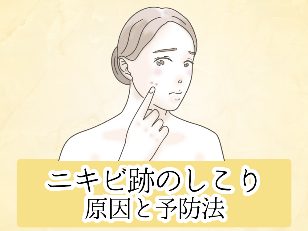ニキビ跡のしこりの原因や種類と予防法!間違った対処法・セルフケアには要注意! | フォーシーズンズ美容皮膚科クリニック美容コラム