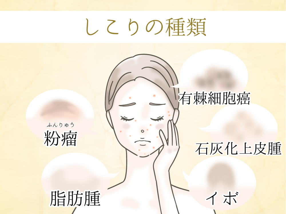 ニキビ跡のしこりの原因や種類と予防法!間違った対処法・セルフケアには要注意! | フォーシーズンズ美容皮膚科クリニック美容コラム