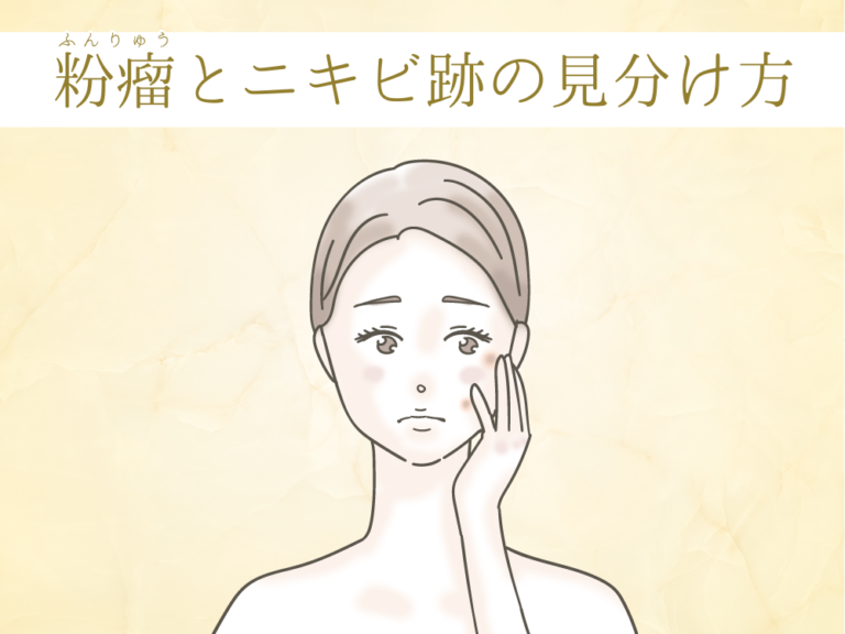 ニキビ跡のしこりの原因や種類と予防法!間違った対処法・セルフケアには要注意! | フォーシーズンズ美容皮膚科クリニック美容コラム