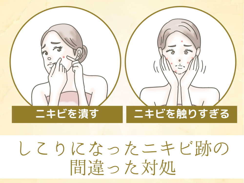 ニキビ跡のしこりの原因や種類と予防法!間違った対処法・セルフケアには要注意! | フォーシーズンズ美容皮膚科クリニック美容コラム