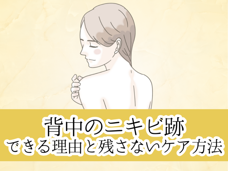 背中のニキビ跡ができる理由は?跡を残さないケア方法や間違えやすい症状も紹介 | フォーシーズンズ美容皮膚科クリニック美容コラム