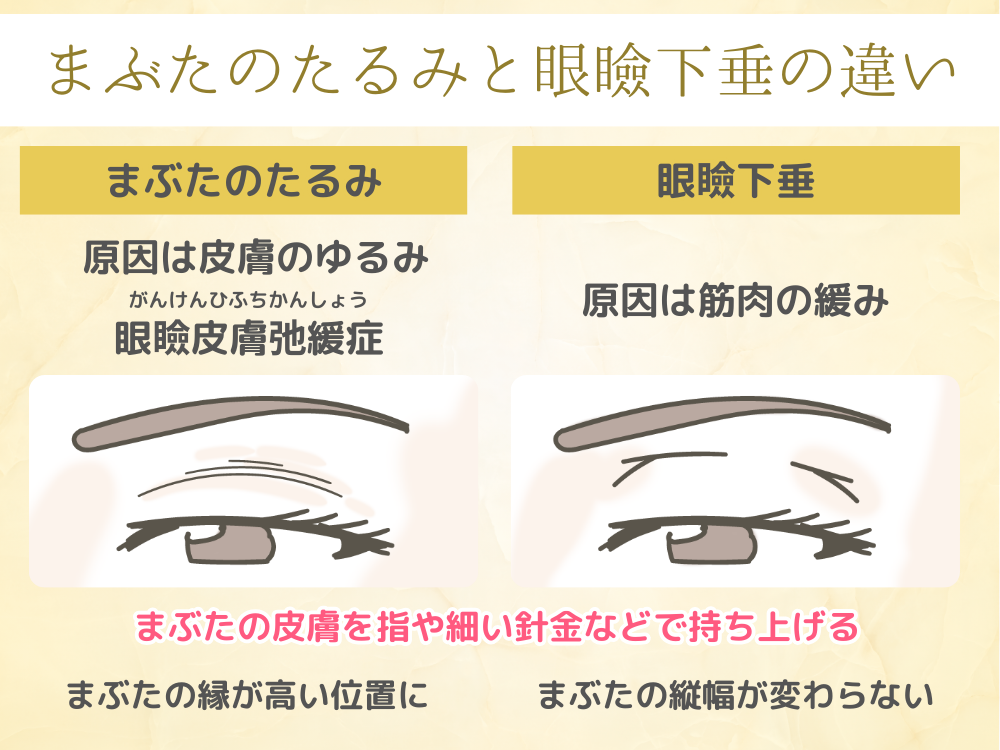 まぶたのたるみでもう悩まない!原因と効果的な改善方法を徹底解説 | フォーシーズンズ美容皮膚科クリニック美容コラム