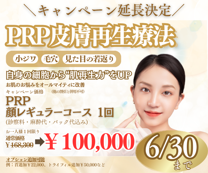 PRPキャンペーン