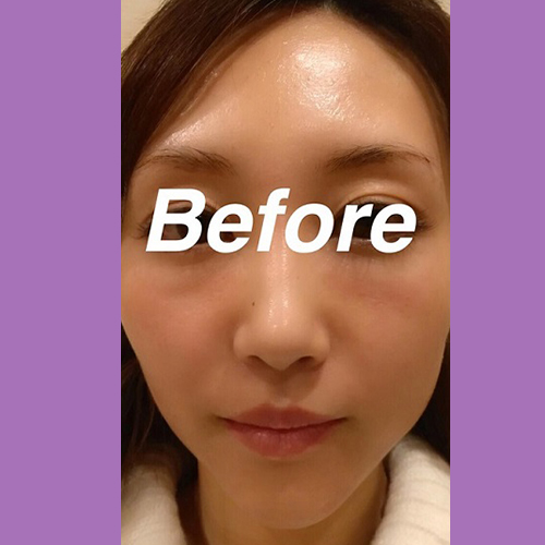 施術前写真