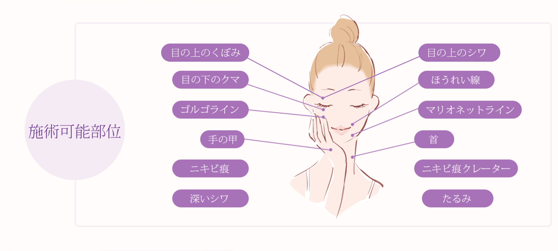 施術可能部位