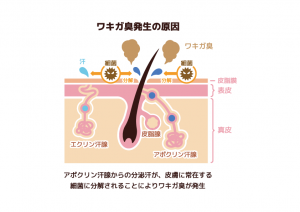 ワキガ臭発生の原因