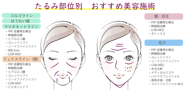 たるみ部位別 おすすめ美容施術
