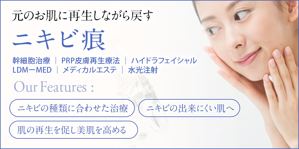 ニキビ痕