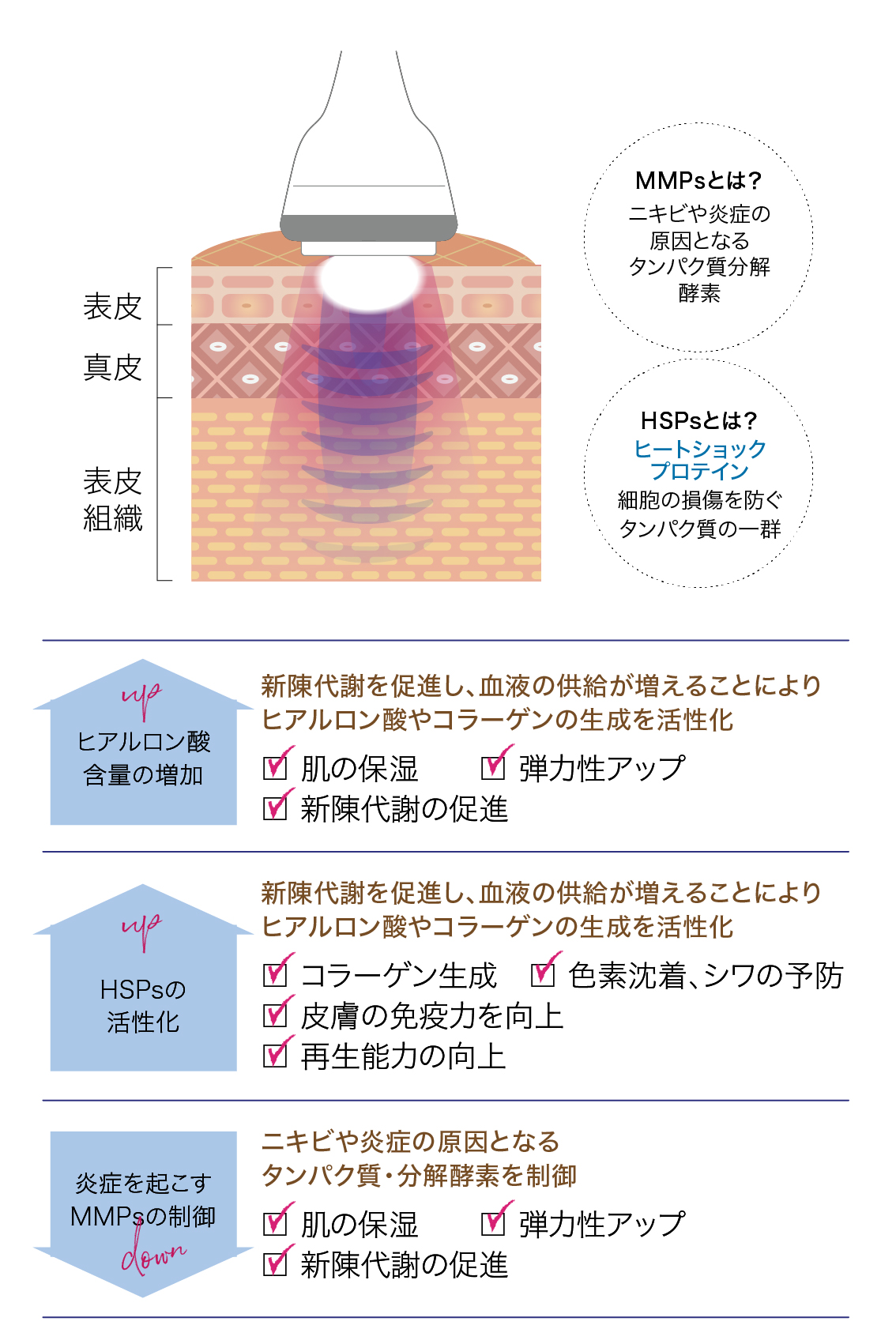 水玉リフティング改善のしくみ