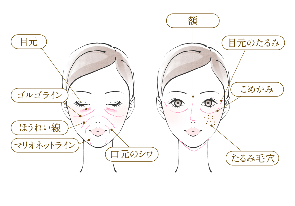 お顔全体のたるみを肌再生からレーザー治療実施のフォーシーズンズ美容皮膚科