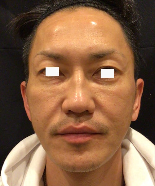 症例No.17施術前の画像