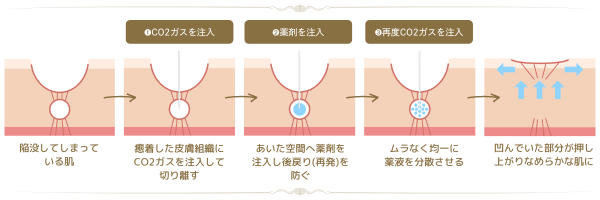 トライフルの効果