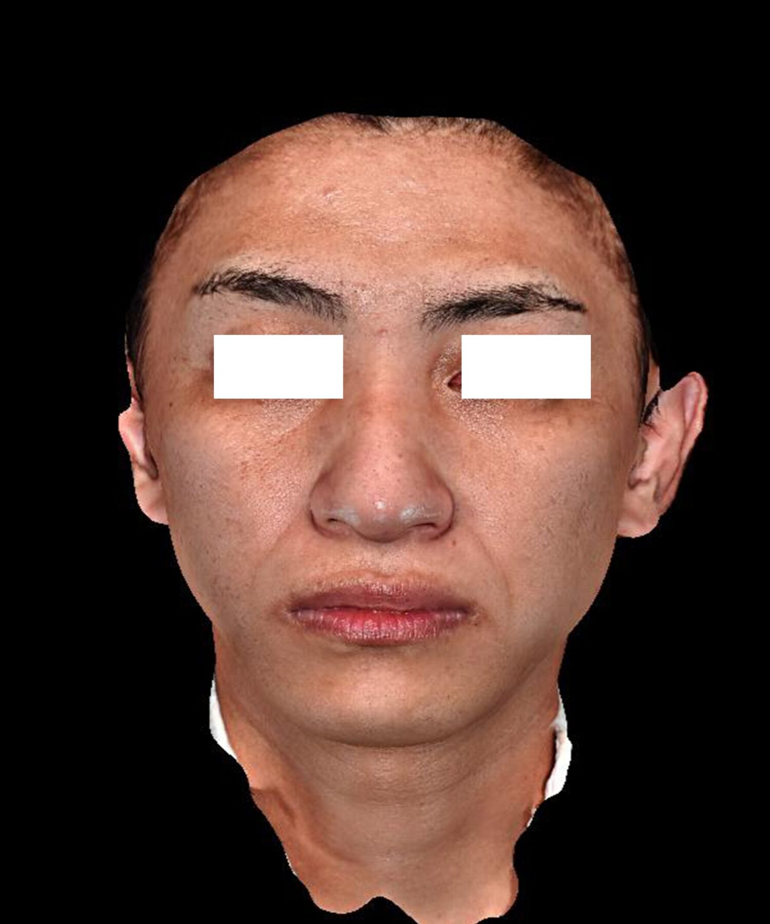 No.82の症例画像