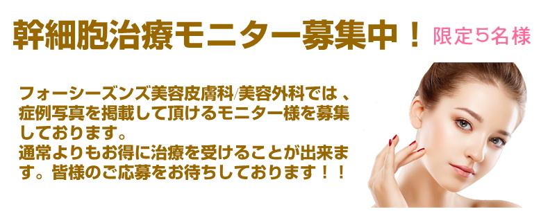 幹細胞治療モニター募集中